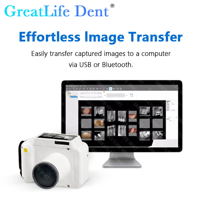 Dent Portable Dental X-ray Mac - Veterinary X-Ray review and price